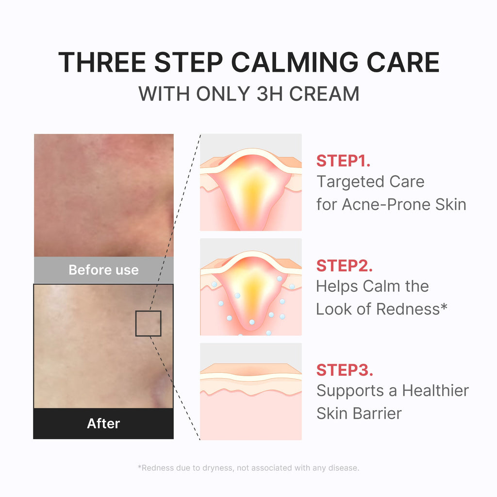 3H Daily Relief Cream